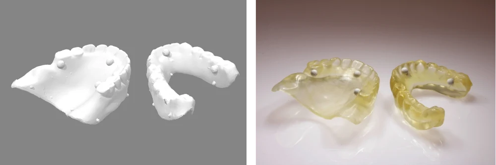 Links die gescannten Prothesen als 3D-Daten, rechts die gedruckten Duplikatprothesen